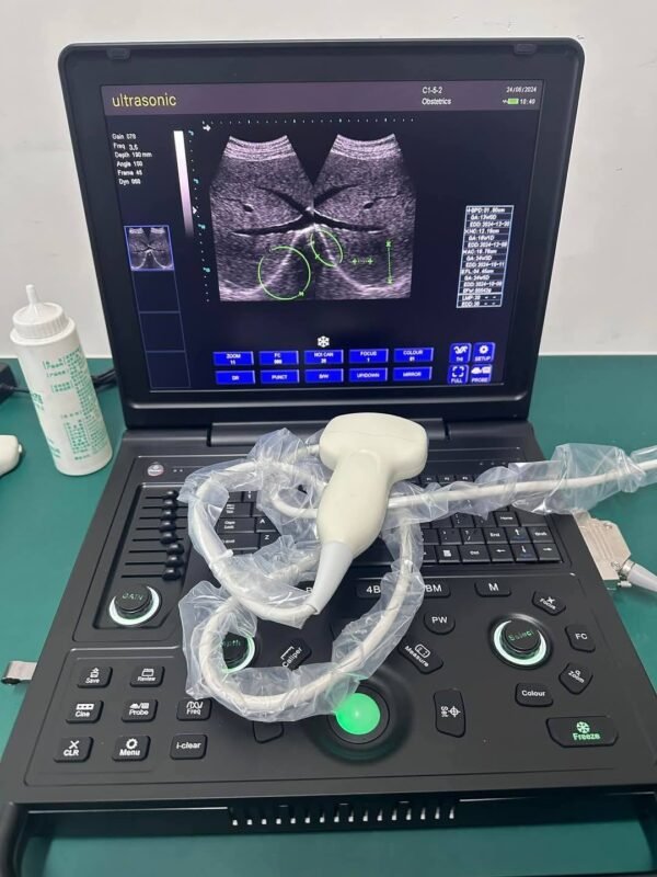 Oriel Notebook Premium Ultrasound Machine