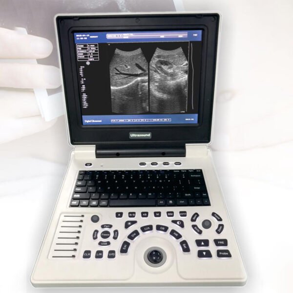 Oriel Notebook Operation Ultrasound Machine