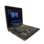 Oriel Notebook Premium Ultrasound Machine