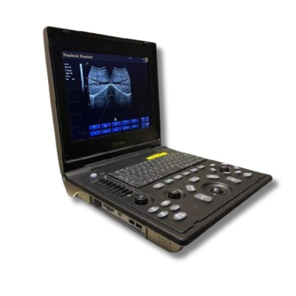 Oriel Notebook Premium Ultrasound Machine