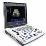 Oriel Notebook Classic Ultrasound Machine