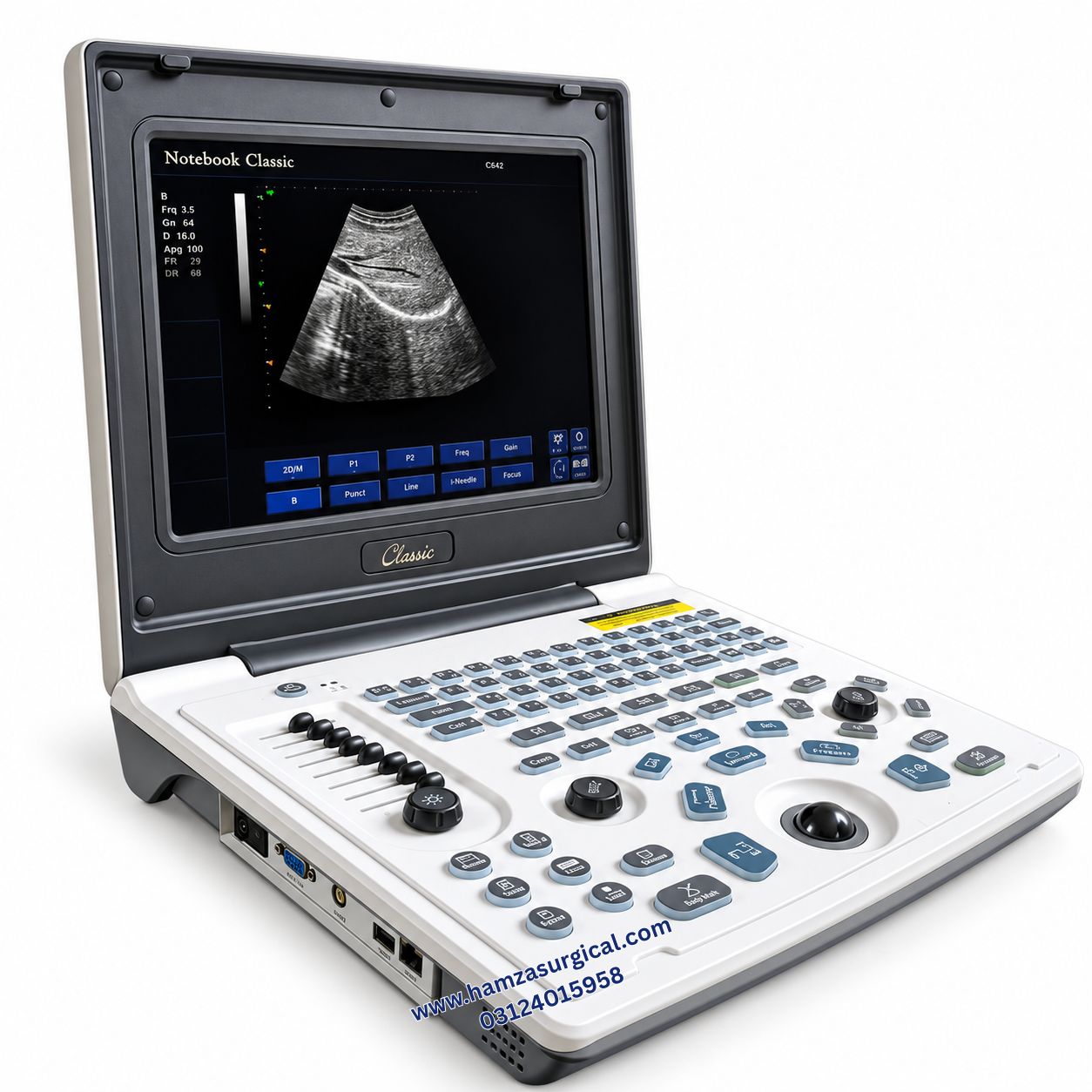 Oriel Notebook Classic Ultrasound Machine
