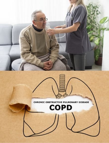copd