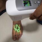 Accurate Vein AV-100 Digital Portable Infrared Vein Finder