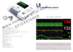 L8 CTG Fetal Maternal Monitor with Single Probe for Single Baby - Image 3