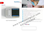 Heartlines H6 6-Channel ECG Machine - Image 2