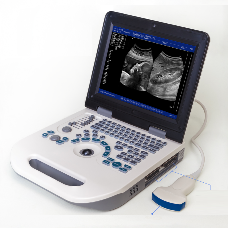 NYRO 10 Portable Ultrasound Machine