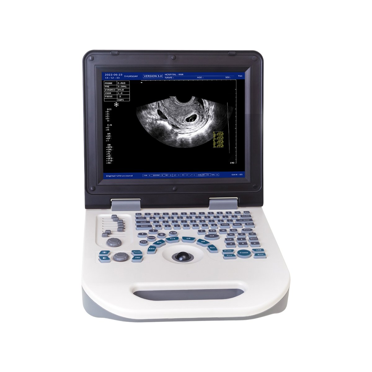 NYRO 10 Portable Ultrasound Machine
