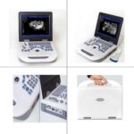 NYRO 10 Portable Ultrasound Machine - Image 4