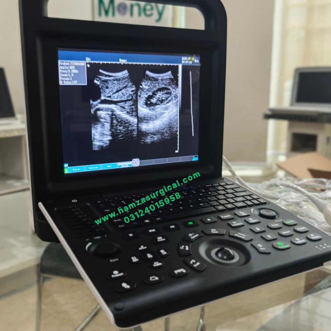 Apollo 9 Portable Ultrasound Machine