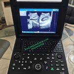 Apollo 9 Portable Ultrasound Machine - Image 4