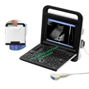 Apollo 9 Portable Ultrasound Machine