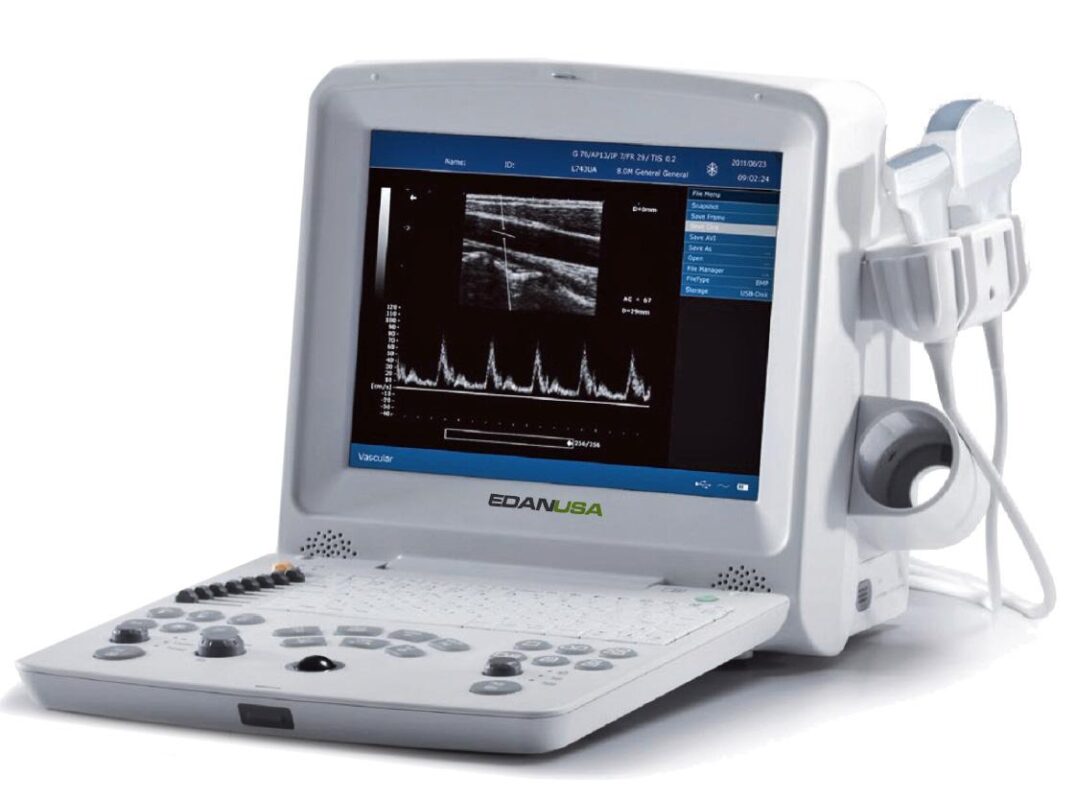 Edan DUS 60 Digital Ultrasonic Diagnostic Imaging System – Portable Ultrasound Machine with PW Doppler & 12.1″ TFT-LCD Display