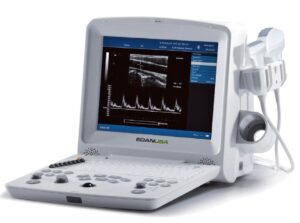 Edan DUS 60 Digital Ultrasonic Diagnostic Imaging System – Portable Ultrasound Machine with PW Doppler & 12.1″ TFT-LCD Display