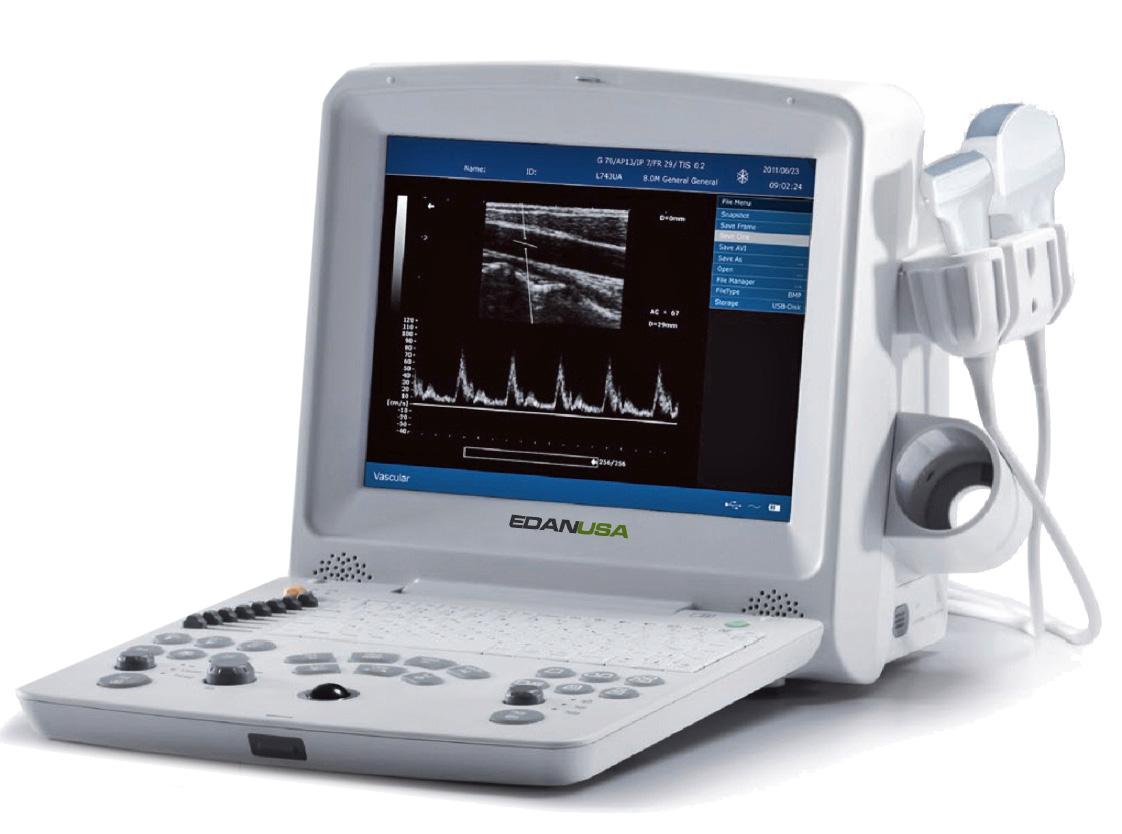 Edan DUS 60 Digital Ultrasonic Diagnostic Imaging System – Portable Ultrasound Machine with PW Doppler & 12.1" TFT-LCD Display Edan DUS 60 Digital Ultrasonic Diagnostic Imaging System – Portable Ultrasound Machine with PW Doppler & 12.1" TFT-LCD Display