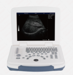 Dawei DW-580 Ultrasound Machine