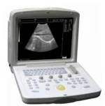 WELLD WED-9618 Full Digital Ultrasonic Diagnostic System – Portable Ultrasound Machine with 12 Inch HD Screen