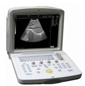 WELLD WED-9618 Full Digital Ultrasonic Diagnostic System – Portable Ultrasound Machine with 12 Inch HD Screen