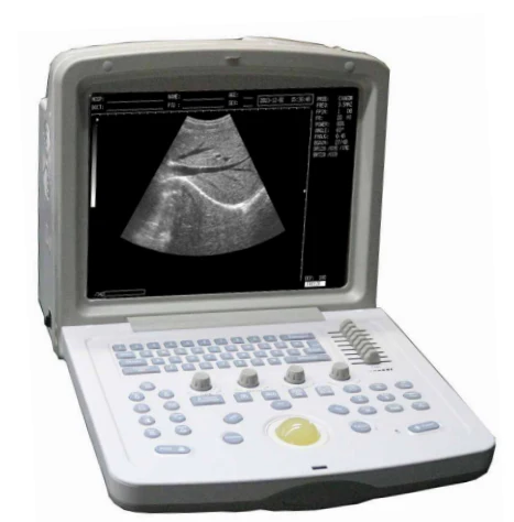WELLD WED-9618 Full Digital Ultrasonic Diagnostic System – Portable Ultrasound Machine with 12 Inch HD Screen
