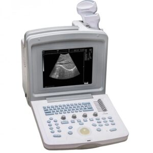 WELLD WED-9618 Full Digital Ultrasonic Diagnostic System – Portable Ultrasound Scanner with 10 Inch HD Screen