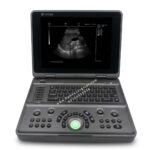 LifeCare LC-1010UL Ultrasound Machine
