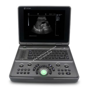 LifeCare LC-1010UL Ultrasound Machine