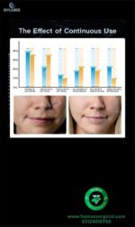 17-in-1 Hydra Facial Dermabrasion Machine - Image 9
